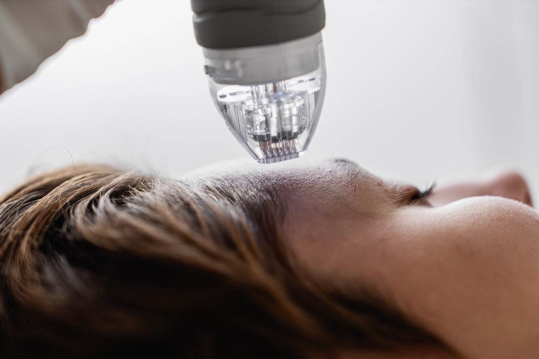 How Often Should You Use a Micro-Infusion System?