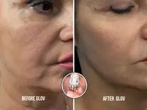 Suero antienvejecimiento ReGlow (5 ml)