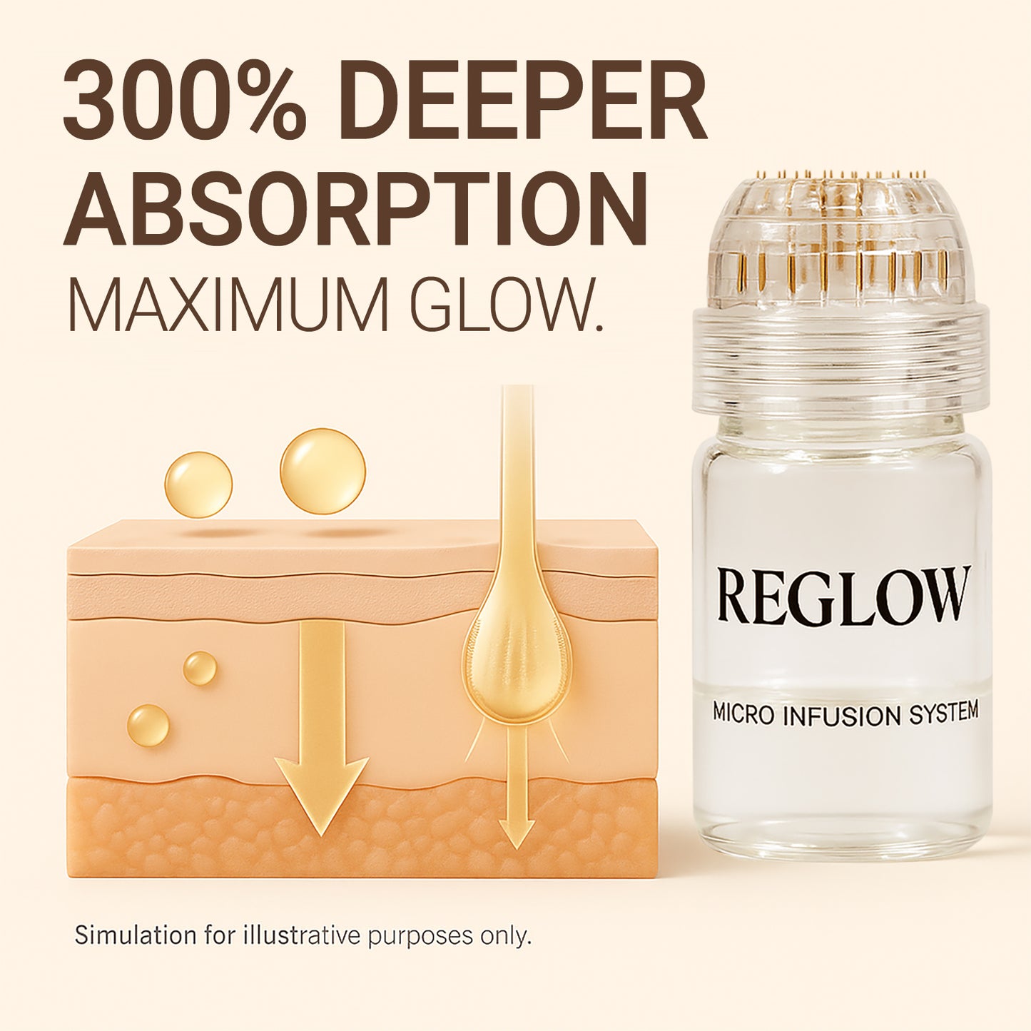 ReGlow 마이크로 주입 시스템