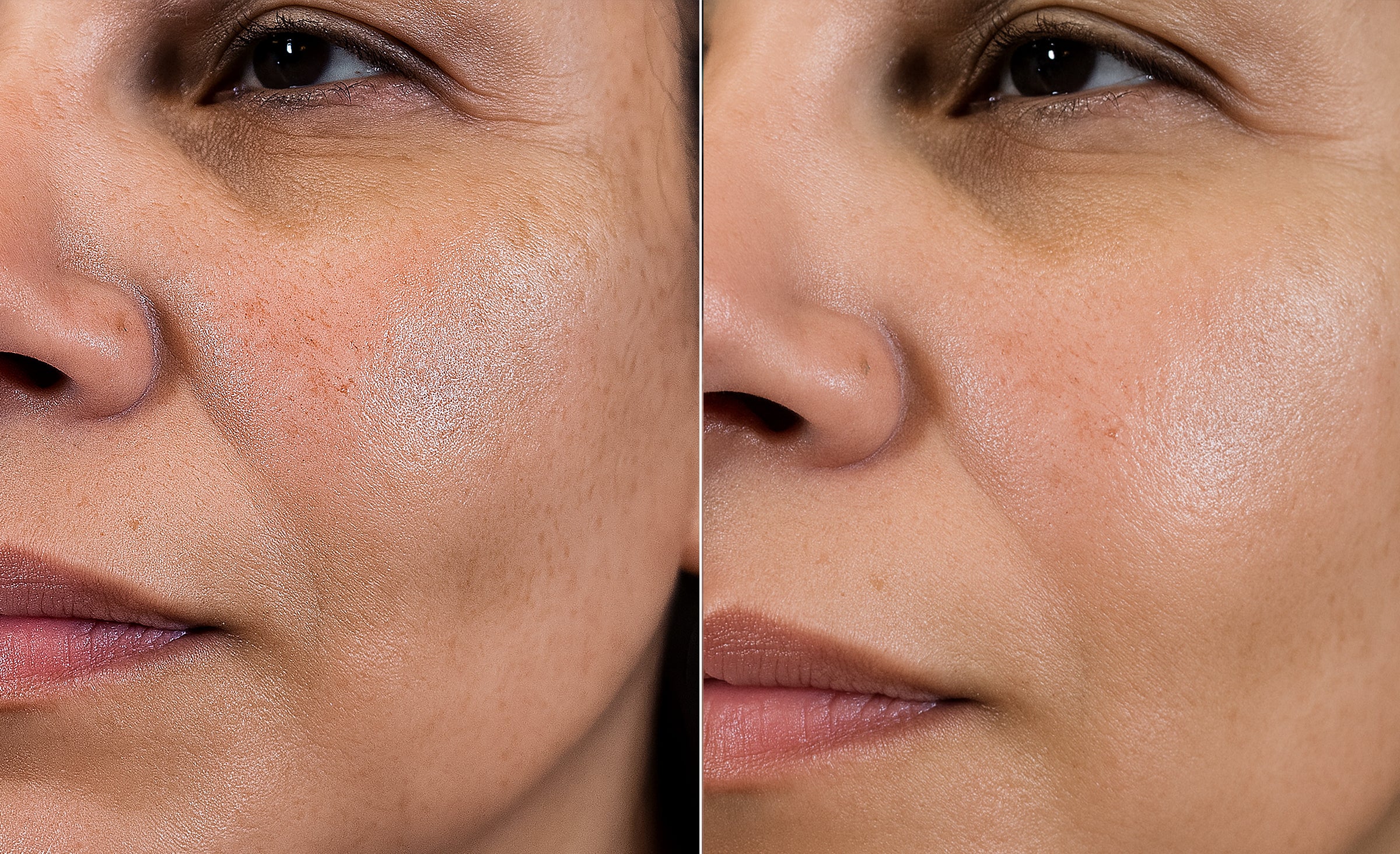 Before/After montage